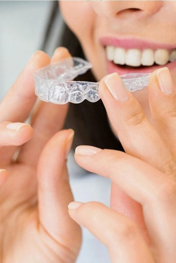 ORTODONZIA INVISIBILE